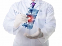 ABOUT INVERTEBRATE HERNIATED DISCS OR HERNIA